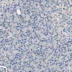 RASD2 Antibody in Immunohistochemistry (IHC)