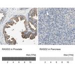 RASD2 Antibody