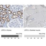 LRP2 Antibody in Immunohistochemistry (IHC)