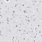 LRP2 Antibody in Immunohistochemistry (IHC)