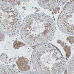 Lass3 Antibody in Immunohistochemistry (IHC)