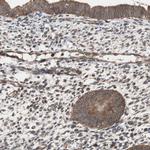 HMBS Antibody in Immunohistochemistry (IHC)