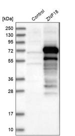 ZNF18 Antibody in Western Blot (WB)