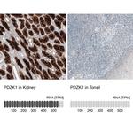 PDZK1 Antibody in Immunohistochemistry (IHC)