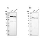 PARN Antibody in Western Blot (WB)