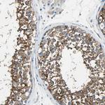 AKAP12 Antibody in Immunohistochemistry (IHC)