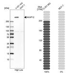 AKAP12 Antibody in Western Blot (WB)