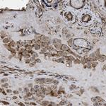 SCUBE2 Antibody in Immunohistochemistry (IHC)