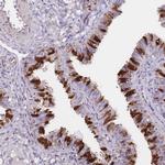 Adenylate Kinase 1 Antibody in Immunohistochemistry (IHC)