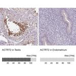 ACTRT2 Antibody in Immunohistochemistry (IHC)