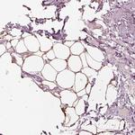 ACACB Antibody in Immunohistochemistry (IHC)