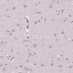 ACACB Antibody in Immunohistochemistry (IHC)