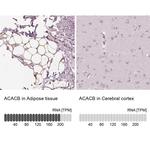 ACACB Antibody