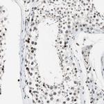 PAXIP1 Antibody in Immunohistochemistry (IHC)