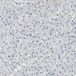 PAXIP1 Antibody in Immunohistochemistry (IHC)