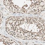 PSMD8 Antibody in Immunohistochemistry (IHC)