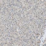 PSMD8 Antibody in Immunohistochemistry (IHC)