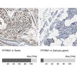 PITRM1 Antibody in Immunohistochemistry (IHC)