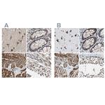 PITRM1 Antibody in Immunohistochemistry (IHC)