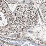 PITRM1 Antibody in Immunohistochemistry (IHC)