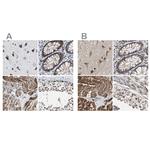 PITRM1 Antibody in Immunohistochemistry (IHC)