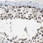 PITRM1 Antibody in Immunohistochemistry (IHC)