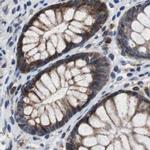 PITRM1 Antibody in Immunohistochemistry (IHC)