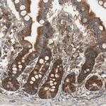 DAP5 Antibody in Immunohistochemistry (IHC)