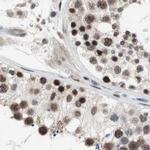 POGZ Antibody in Immunohistochemistry (IHC)