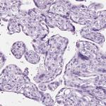 SCG3 Antibody in Immunohistochemistry (IHC)