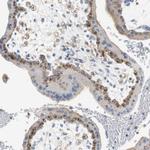 VAMP8 Antibody in Immunohistochemistry (IHC)