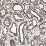 RAB7 Antibody in Immunohistochemistry (IHC)