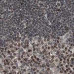 ZHX2 Antibody in Immunohistochemistry (IHC)