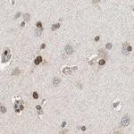 ZHX2 Antibody in Immunohistochemistry (IHC)