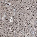 ZHX2 Antibody in Immunohistochemistry (IHC)