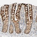 ACSL5 Antibody in Immunohistochemistry (IHC)