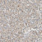 ACSL5 Antibody in Immunohistochemistry (IHC)