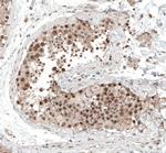 ALKBH5 Antibody in Immunohistochemistry (IHC)