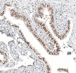 ALKBH5 Antibody in Immunohistochemistry (IHC)