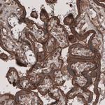 LSR Antibody in Immunohistochemistry (IHC)