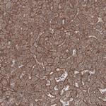 LSR Antibody in Immunohistochemistry (IHC)