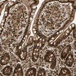 ZSCAN30 Antibody in Immunohistochemistry (IHC)