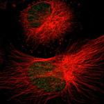 SGCG Antibody in Immunocytochemistry (ICC/IF)