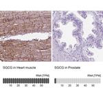 SGCG Antibody in Immunohistochemistry (IHC)