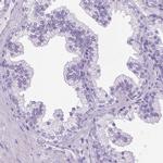 SGCG Antibody in Immunohistochemistry (IHC)