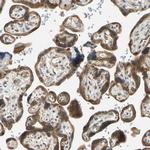 WIPI1 Antibody in Immunohistochemistry (IHC)