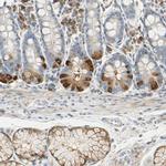 WIPI1 Antibody in Immunohistochemistry (IHC)