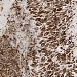 P4HA1 Antibody in Immunohistochemistry (IHC)