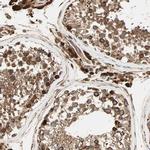 P4HA1 Antibody in Immunohistochemistry (IHC)