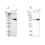 P4HA1 Antibody in Western Blot (WB)